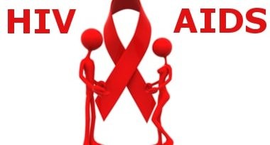 HIV AND AIDS MANAGEMENT